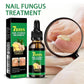 Nail treatment – Natural antifungal care 